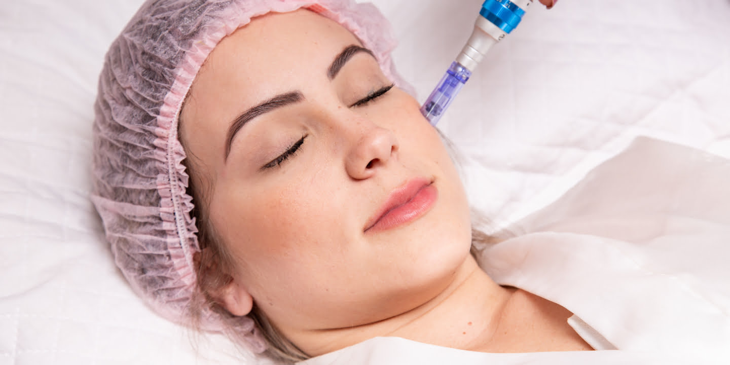 Derma Roller and Derma Pen